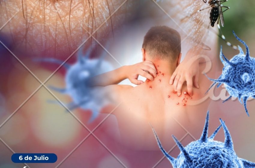  El municipio de Sauce de Luna recuerda: 6 de julio  día mundial de la zoonosis 